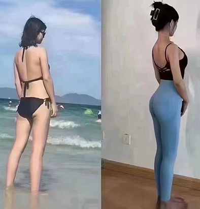 体型体态调整